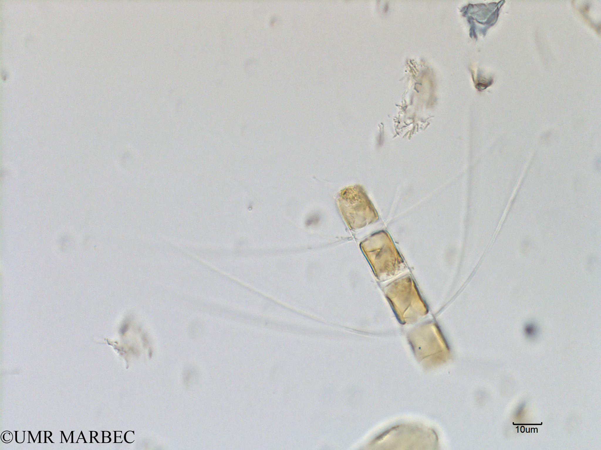 phyto/Scattered_Islands/mayotte_lagoon/SIREME May 2016/Chaetoceros sp34 (MAY5_cf chaetoceros sp -6).tif(copy).jpg